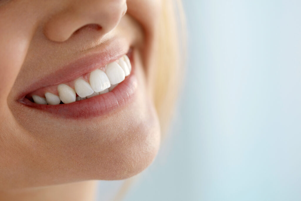 Close up of woman's white, bright smile after teeth whitening with boutique teeth whitening